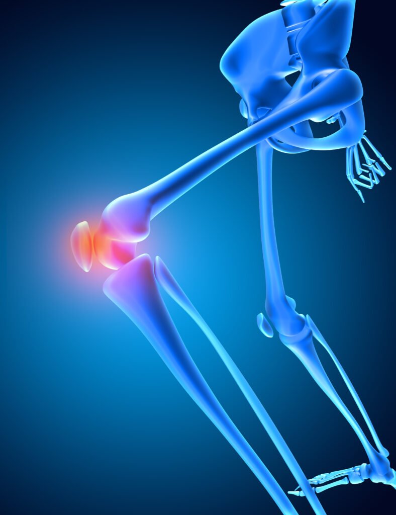 Cure of knee pain